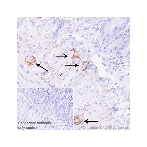 22815. RECOMBINANT ANTI-NCAM1 ANTIBODY (EPR21827) - BSA AND AZIDE FREE 100UG ABCAM