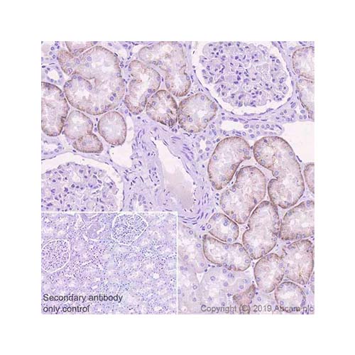 22818. RECOMBINANT ANTI-GLUCOSE TRANSPORTER GLUT2 ANTIBODY (EPR22946-74) 100UL ABCAM