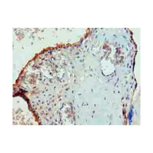 22819. ANTI-PGS1 ANTIBODY 100UG ABCAM