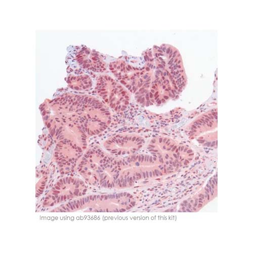 22821. MOUSE AND RABBIT SPECIFIC HRP/AEC IHC DETECTION KIT-MICRO-POLYMER 15ML ABCAM