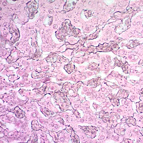 26410. RETICULUM STAIN KIT (MODIFIED GOMORIS) 100 TESTS ABCAM