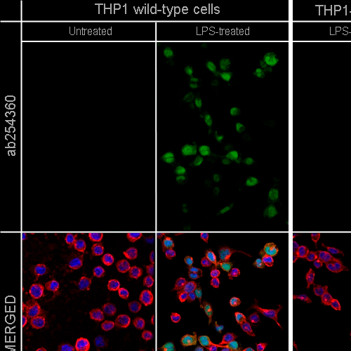 26426. RECOMBINANT ANTI-IL-1 BETA ANTIBODY (EPR23851-127) 100UL ABCAM