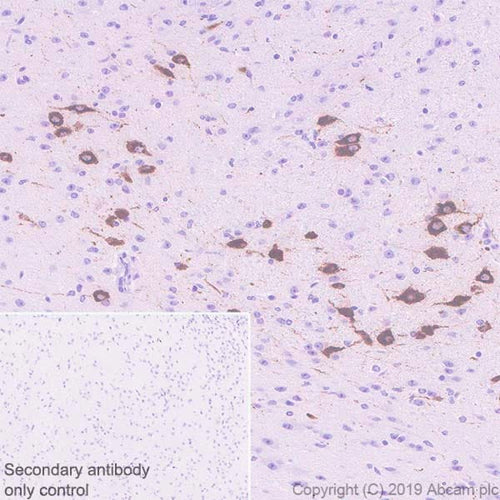 4644. RECOMBINANT ANTI-OREXIN B ANTIBODY (EPR22803-18) 100UL - ABCAM