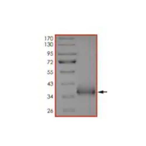 5986. RECOMBINANT HUMAN CORONAVIRUS SARS-COV-2 SPYKE GLYCOPROTEIN RBD (ACTIVE) 50UG - ABCAM