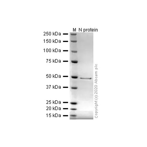 4626. RECOMBINANT HUMAN SARS-COV-2 NUCLEOCAPSID PROTEIN (HIS TAG) 100UG - ABCAM