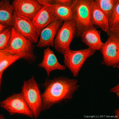 26405. ANTI-O-LINKED N-ACETYLGLUCOSAMINE ANTIBODY (RL2) 100UG ABCAM