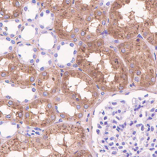 26404. RECOMBINANT ANTI-GLUTATHIONE PEROXIDASE 3/GPX-3 ANTIBODY (EPR19951-136) 100UL ABCAM