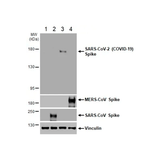 55765. RECOMBINANT ANTI-SARS-COV-2 SPIKE GLYCOPROTEIN S1 ANTIBODY (HL6)-BSA AND AZIDE FREE 100UL ABCAM
