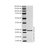 26510. RECOMBINANT HUMAN C-REACTIVE PROTEIN/CRP PROTEIN 100UG ABCAM