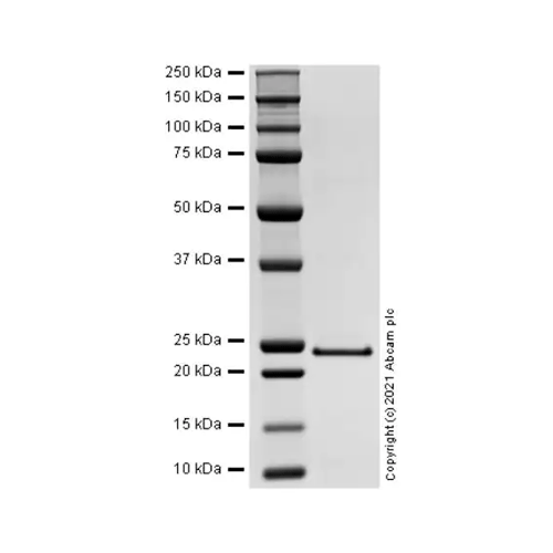 26510. RECOMBINANT HUMAN C-REACTIVE PROTEIN/CRP PROTEIN 100UG ABCAM