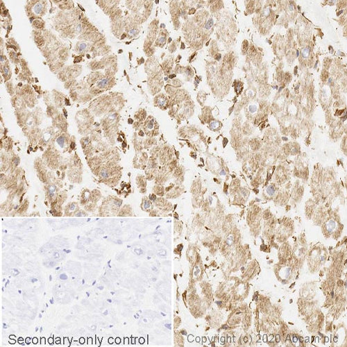 4662. RECOMBINANT ANTI-MTOR ANTIBODY (Y391) 100UL - ABCAM