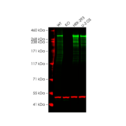 17822. RECOMBINANT ANTI-ATM ANTIBODY (Y170) 100UL ABCAM