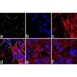 26448. ANTI-PERILIPIN-1 ANTIBODY 100UL ABCAM