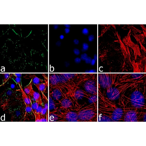 26448. ANTI-PERILIPIN-1 ANTIBODY 100UL ABCAM