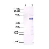2940. RABBIT POLYCLONAL TO MMP13 100UG - ABCAM
