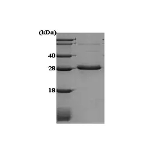 26421. RECOMBINANT HUMAN ADIPONECTIN PROTEIN 100UG ABCAM