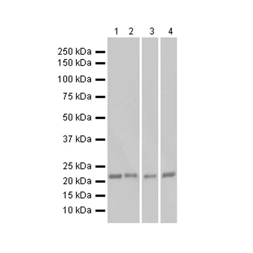 6941. RECOMBINANT ANTI-RAS ANTIBODY (EP1125Y) 100UL - ABCAM