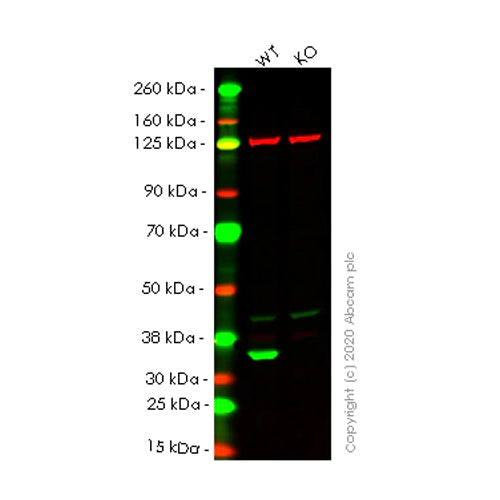 4638. RECOMBINANT ANTI-LACTATE DEHYDROGENASE B/LDH-B ANTIBODY (EP1565Y) 100UL - ABCAM