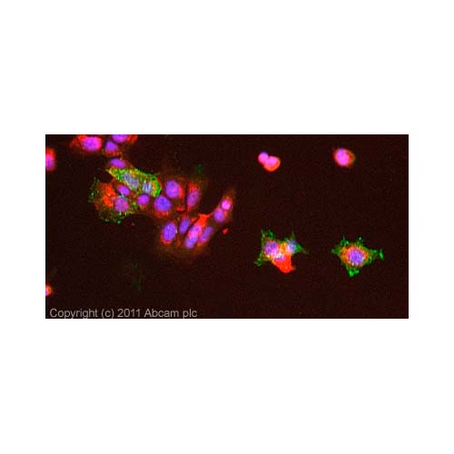 21929. ANTI-GLUCOSE TRANSPORTER GLUT2 ANTIBODY 25UG - ABCAM