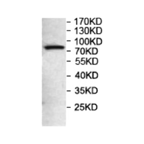 6960. ANTI FOXP2 ANTIBODY 200UL ABCAM