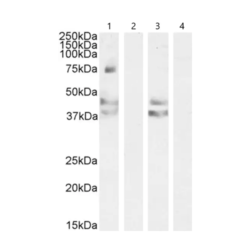 26477. ANTI-ANGIOTENSIN II TYPE 1 RECEPTOR ANTIBODY 200UL ABCAM