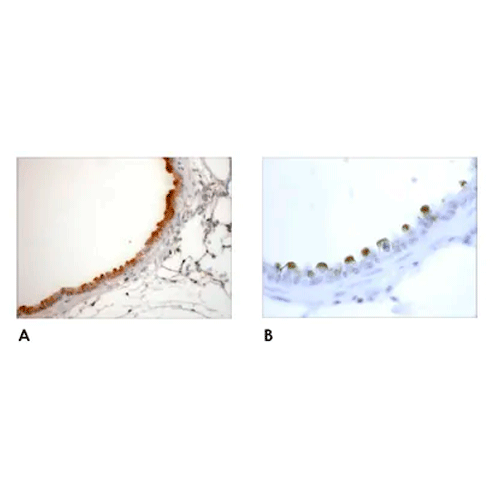 26487. ANTI CLATHRIN HEAVY CHAIN (AB59710) 100UL ABCAM