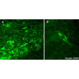 4686. ANTI-TYROSINE HYDROXYLASE ANTIBODY 50UL - ABCAM