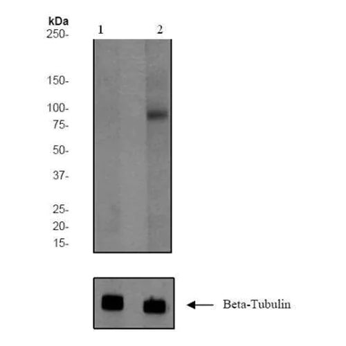 4628. ANTI-INSULIN RECEPTOR (PHOSPHO Y1185) ANTIBODY (EP351(2)Y) 100UL - ABCAM