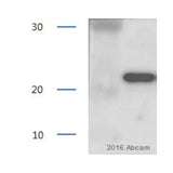 2934. ANTI-LIPOCALIN-2 / NGAL ANTIBODY 50UG ABCAM