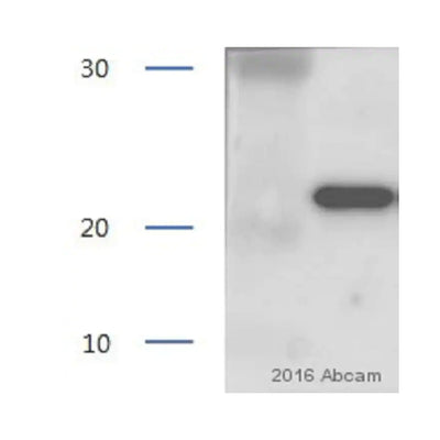 2934. ANTI-LIPOCALIN-2 / NGAL ANTIBODY 50UG ABCAM