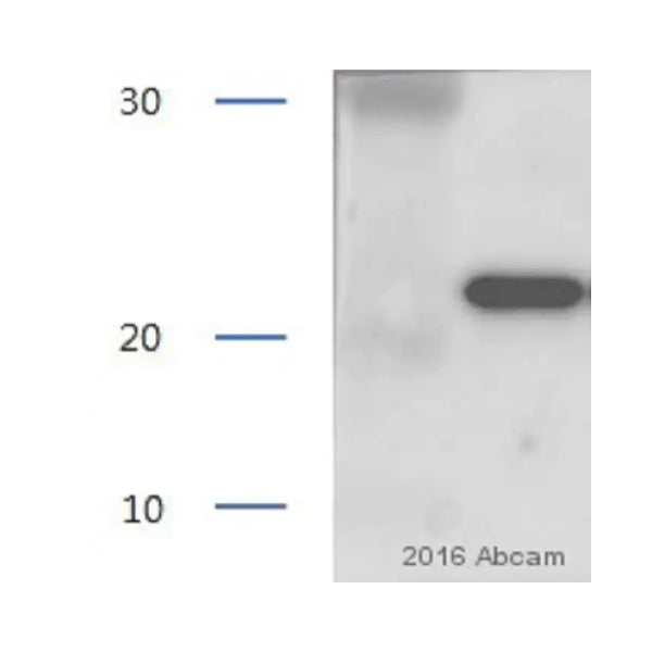 2934. ANTI-LIPOCALIN-2 / NGAL ANTIBODY 50UG ABCAM