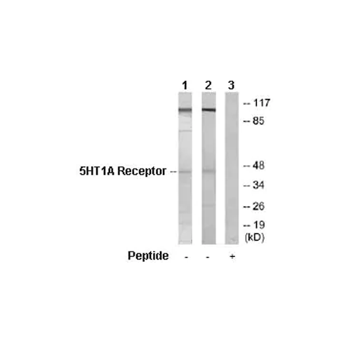 26465. ANTI-5HT1A RECEPTOR ANTIBODY 100UG ABCAM