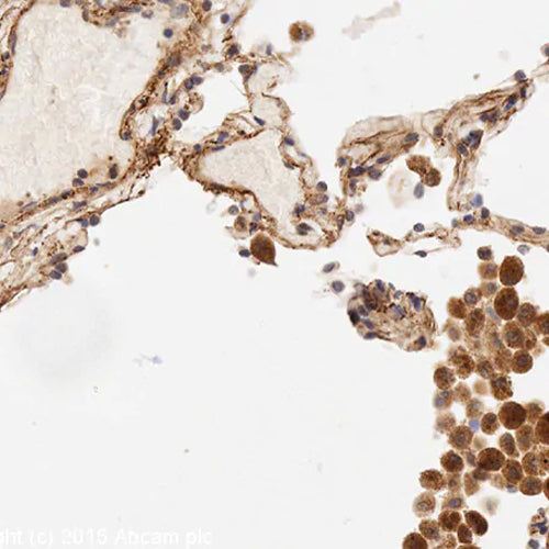 4660. ANTI-IL-6 ANTIBODY 200UL - ABCAM