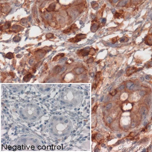 5539. GOAT POLYCLONAL TO MOUSE IGG-H&L 1MG ABCAM