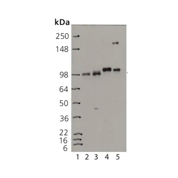 2925. ANTI-INSULIN RECEPTOR BETA ANTIBODY (C18C4) 100UG ABCAM