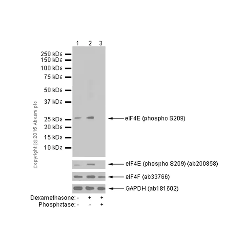 26444. RECOMBINANT ANTI-EIF4E (PHOSPHO S209) ANTIBODY (EP2151Y) 100UL ABCAM