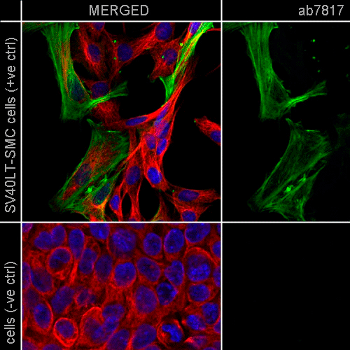 26402. ANTI-ALPHA SMOOTH MUSCLE ACTIN ANTIBODY (1A4) 100UG ABCAM