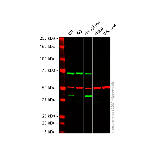 26455. ANTI-CX3CR1 ANTIBODY 100UG ABCAM