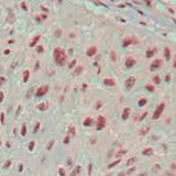 26454. ANTI-ISLET 1 ANTIBODY (1H9) 100UL ABCAM