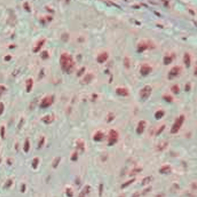 26454. ANTI-ISLET 1 ANTIBODY (1H9) 100UL ABCAM