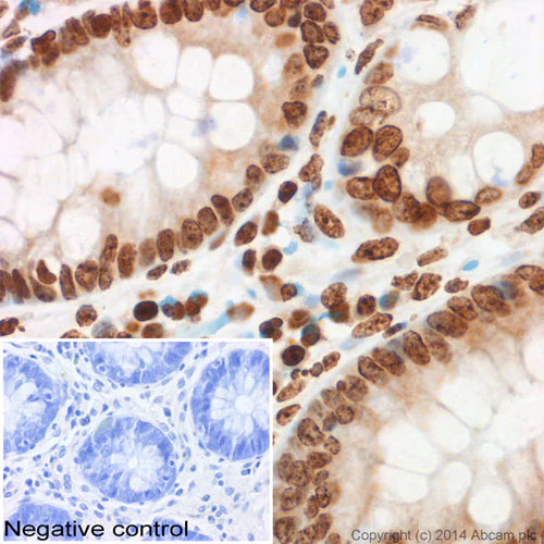 4647. ANTI-HISTONE H3 (TRI METHYL K9) ANTIBODY - CHIP GRADE 100UG - ABCAM