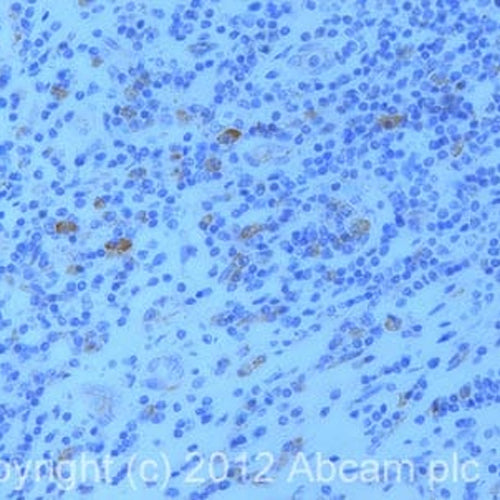 4619. ANTI-UCP2 ANTIBODY 100UG - ABCAM