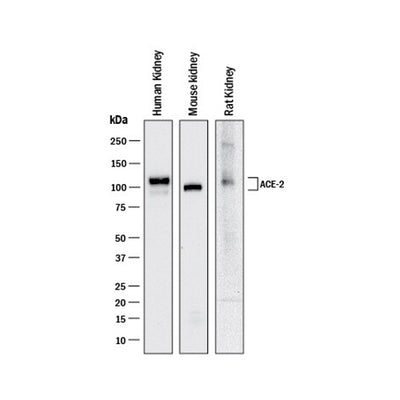 7515. HUMAN/MOUSE/RAT/HAMSTER ACE-2 ANTIBODY 100UG - R&D SYSTEMS