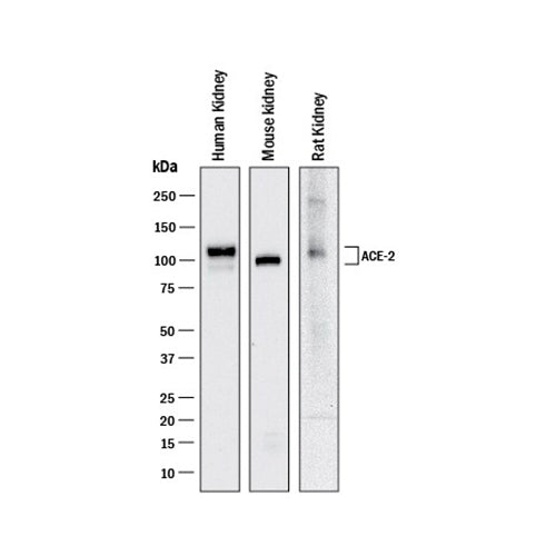 7515. HUMAN/MOUSE/RAT/HAMSTER ACE-2 ANTIBODY 100UG - R&D SYSTEMS
