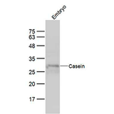 6427. CASEIN POLYCLONAL ANTIBODY 100UL BIOSS ANTIBODIES