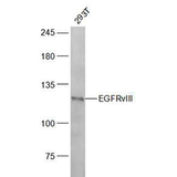 6432. EGFRVIII POLYCLONAL ANTIBODY 100UL BIOSS ANTIBODIES - THERMO SCIENTIFC