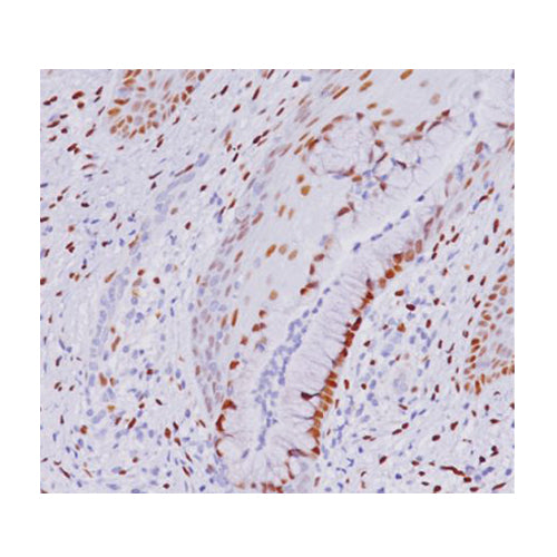 23044. ESTROGEN RECEPTOR (ER) (SP1) 0.5ML BIOCARE MEDICAL