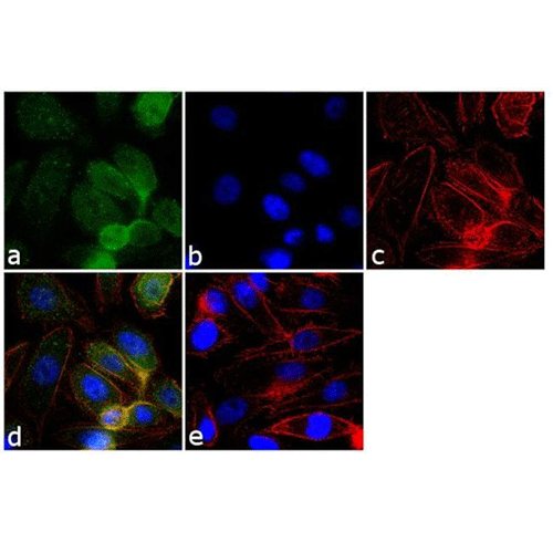 22475. GRK2 MONOCLONAL ANTIBODY (5D5) 100UG INVITROGEN