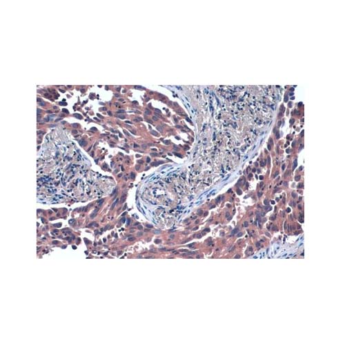 21865. TSG101 MONOCLONAL ANTIBODY 100UL - INVITROGEN