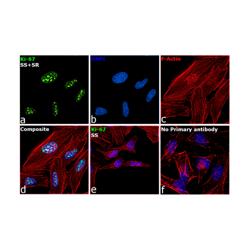 18054. RECOMBINANT RABBIT MONOCLONAL KI-67 ANTIBODY SP6 500UL - INVITROGEN